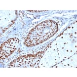 Immunohistochemistry - Anti-Nucleophosmin Antibody [NPM1/1902] (A249525) - Antibodies.com