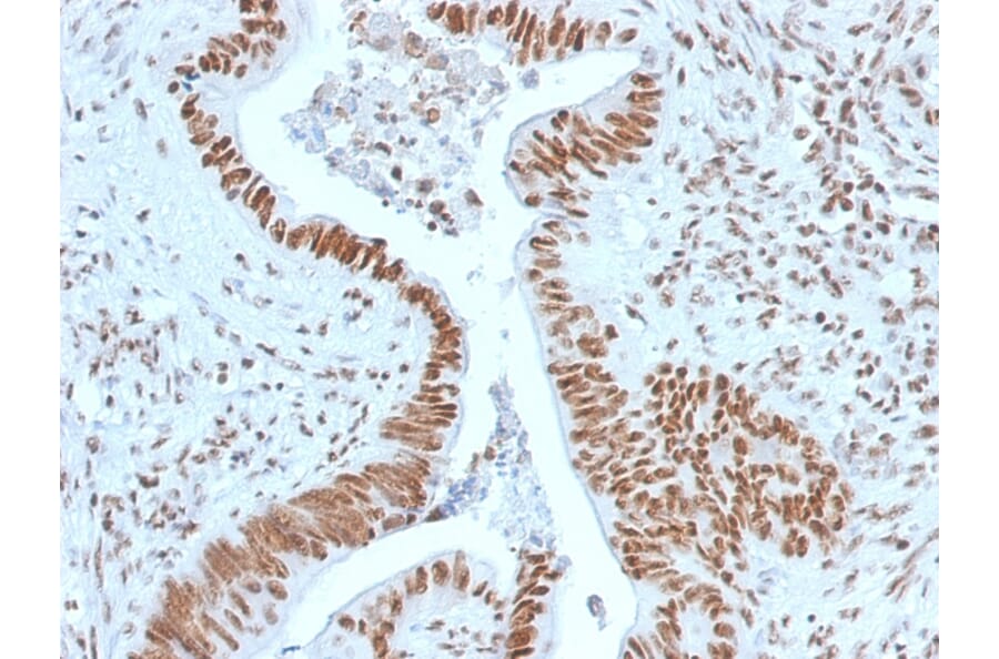 Immunohistochemistry - Anti-Nucleophosmin Antibody [NPM1/1902] (A249525) - Antibodies.com