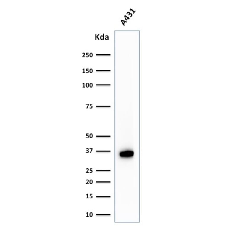 Western Blot - Anti-Nucleophosmin Antibody [NPM1/1902] (A249525) - Antibodies.com