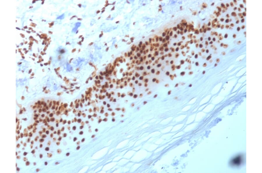 Immunohistochemistry - Anti-Nucleophosmin Antibody [NA24] (A249525) - Antibodies.com