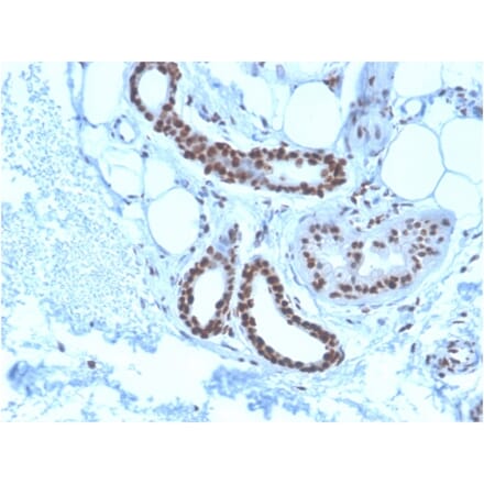Immunohistochemistry - Anti-Nucleophosmin Antibody [NPM1/3285] (A249527) - Antibodies.com