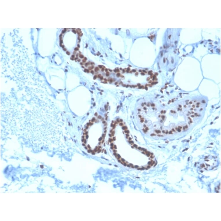 Immunohistochemistry - Anti-Nucleophosmin Antibody [NPM1/3285] (A249527) - Antibodies.com