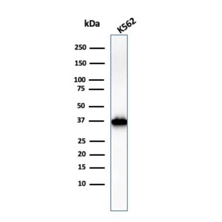 Western Blot - Anti-Nucleophosmin Antibody [NPM1/3286] (A249528) - Antibodies.com
