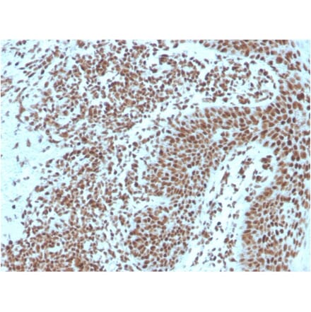 Immunohistochemistry - Anti-Nucleophosmin Antibody [NPM1/3287] (A249529) - Antibodies.com