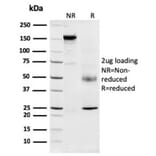 SDS-PAGE - Anti-Nucleophosmin Antibody [NPM1/3287] (A249529) - Antibodies.com