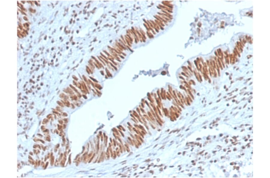 Immunohistochemistry - Anti-Nucleophosmin Antibody [NPM1/3398] (A249530) - Antibodies.com