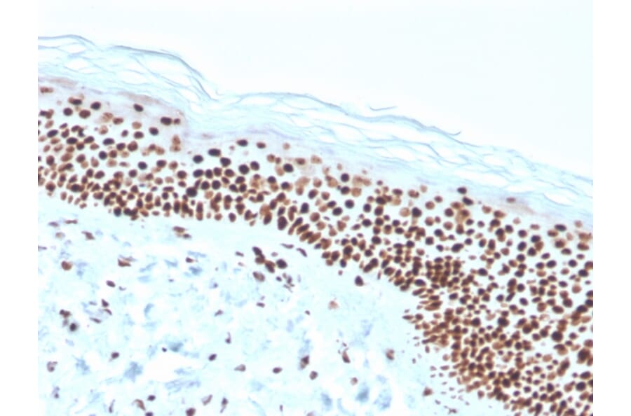 Immunohistochemistry - Anti-Nucleophosmin Antibody [rNPM1/1901] (A249531) - Antibodies.com