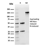 SDS-PAGE - Anti-Nucleophosmin Antibody [rNPM1/1901] (A249531) - Antibodies.com
