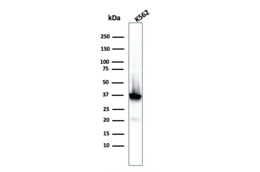 Western Blot - Anti-Nucleophosmin Antibody [rNPM1/1901] (A249531) - Antibodies.com