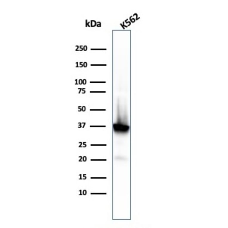 Western Blot - Anti-Nucleophosmin Antibody [rNPM1/1901] (A249531) - Antibodies.com