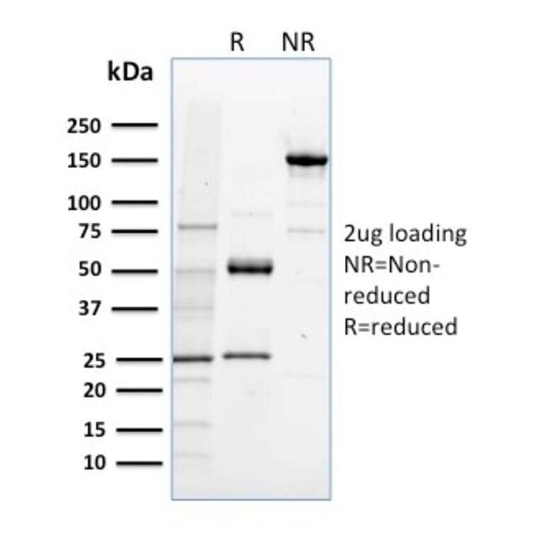 SDS-PAGE - Anti-NRF1 Antibody [NRF1/2608] (A249532) - Antibodies.com