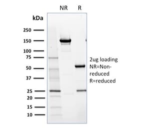 SDS-PAGE - Anti-NRF1 Antibody [NRF1/2609] (A249533) - Antibodies.com