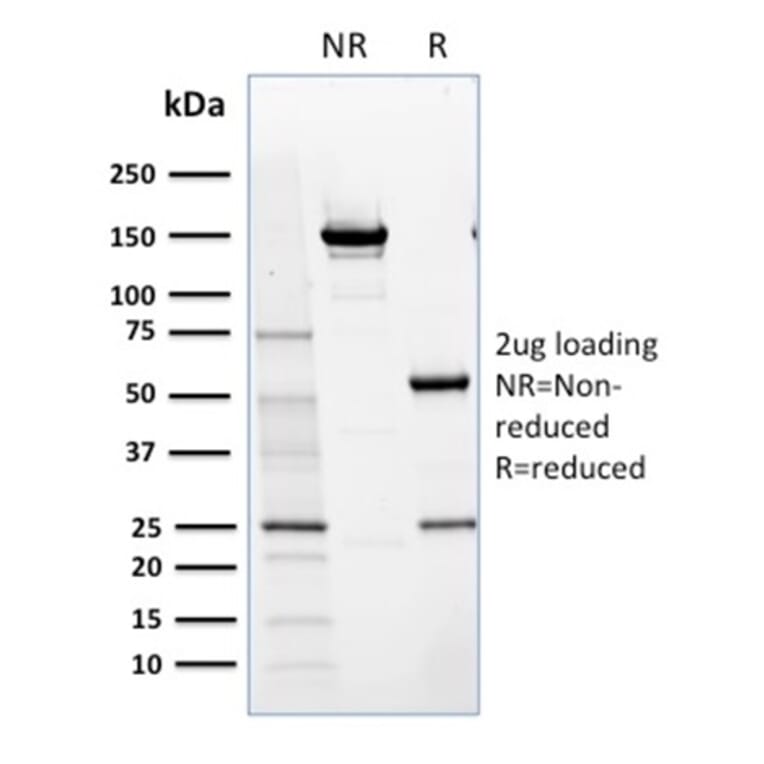 SDS-PAGE - Anti-NRF1 Antibody [NRF1/2609] (A249533) - Antibodies.com