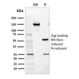 SDS-PAGE - Anti-NRF1 Antibody [NRF1/2609] (A249533) - Antibodies.com