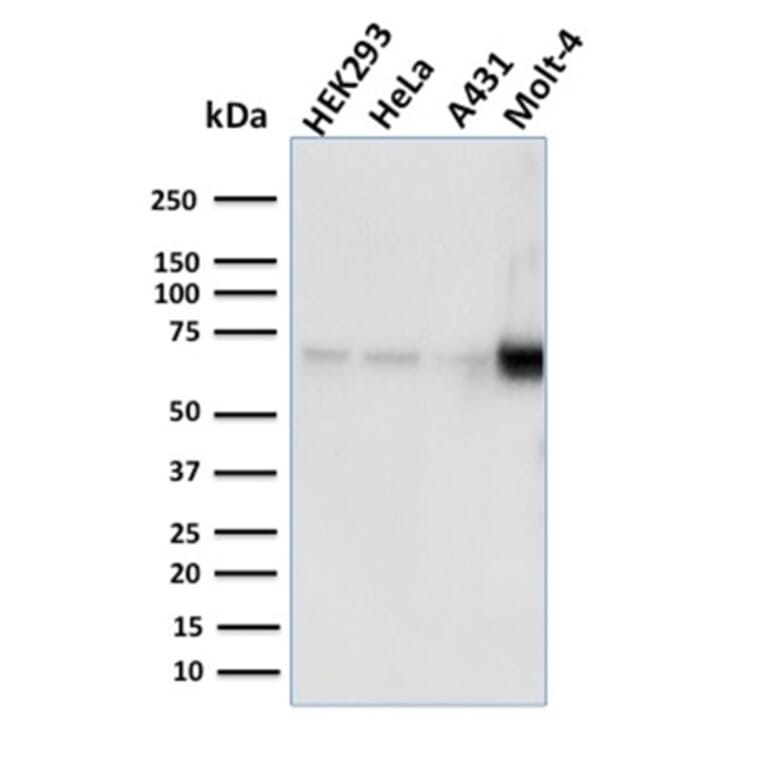 Western Blot - Anti-NRF1 Antibody [NRF1/2609] (A249533) - Antibodies.com