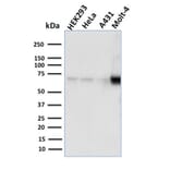 Western Blot - Anti-NRF1 Antibody [NRF1/2609] (A249533) - Antibodies.com