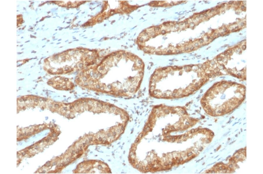Immunohistochemistry - Anti-YB1 Antibody [YBX1/2430] (A249534) - Antibodies.com