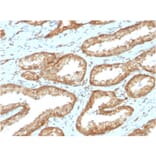 Immunohistochemistry - Anti-YB1 Antibody [YBX1/2430] (A249534) - Antibodies.com