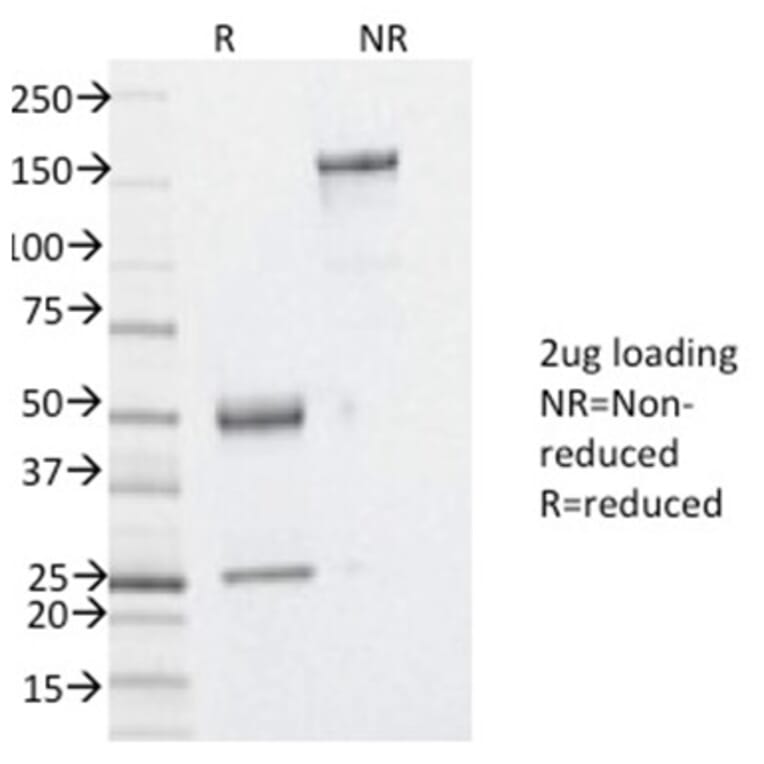 SDS-PAGE - Anti-YB1 Antibody [YBX1/2430] (A249534) - Antibodies.com