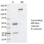 SDS-PAGE - Anti-YB1 Antibody [YBX1/2430] (A249534) - Antibodies.com