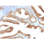 Immunohistochemistry - Anti-YB1 Antibody [rYBX1/2430] (A249534) - Antibodies.com