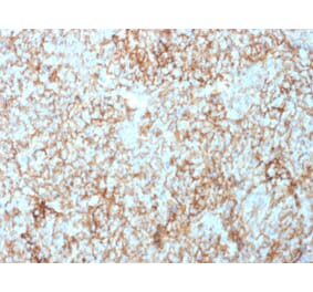 Immunohistochemistry - Anti-CD73 Antibody [NT5E/2503] (A249536) - Antibodies.com