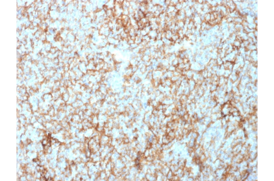 Immunohistochemistry - Anti-CD73 Antibody [NT5E/2503] (A249536) - Antibodies.com