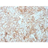 Immunohistochemistry - Anti-CD73 Antibody [NT5E/2503] (A249536) - Antibodies.com