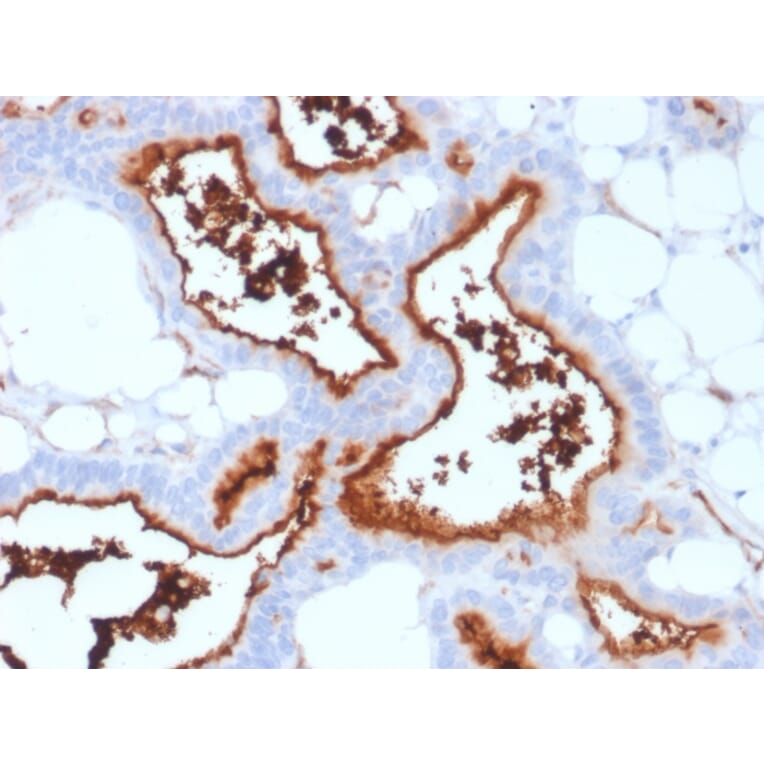 Immunohistochemistry - Anti-CD73 Antibody [NT5E/2503] (A249536) - Antibodies.com