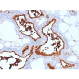 Immunohistochemistry - Anti-CD73 Antibody [NT5E/2503] (A249536) - Antibodies.com