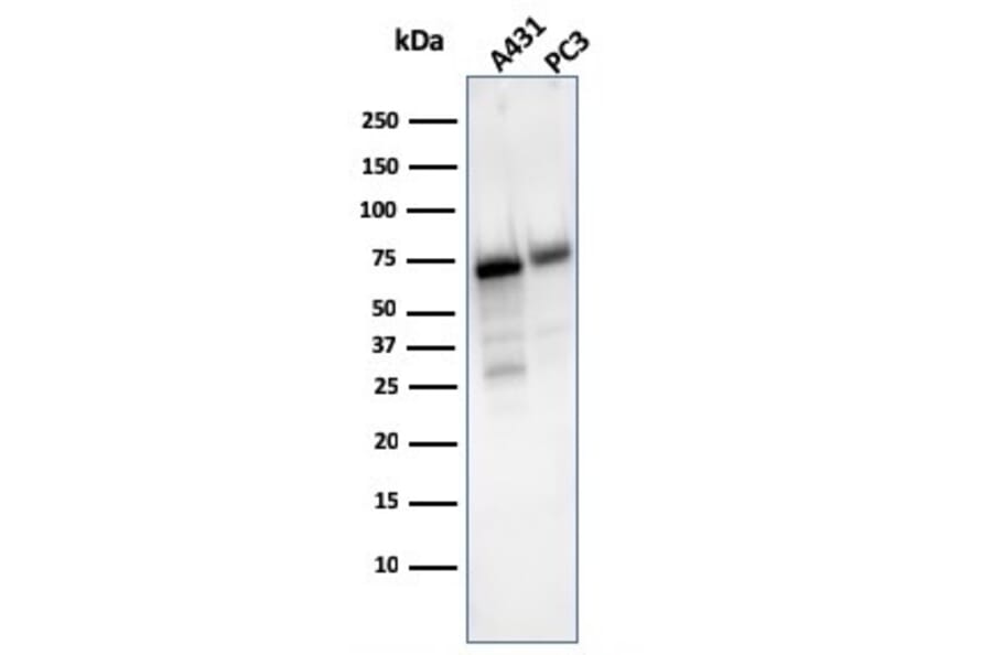 Western Blot - Anti-CD73 Antibody [NT5E/2503] (A249536) - Antibodies.com