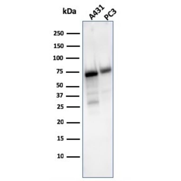 Western Blot - Anti-CD73 Antibody [NT5E/2503] (A249536) - Antibodies.com