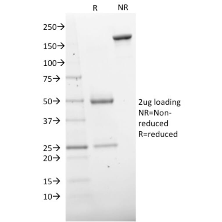 SDS-PAGE - Anti-CD73 Antibody [NT5E/2503] (A249536) - Antibodies.com
