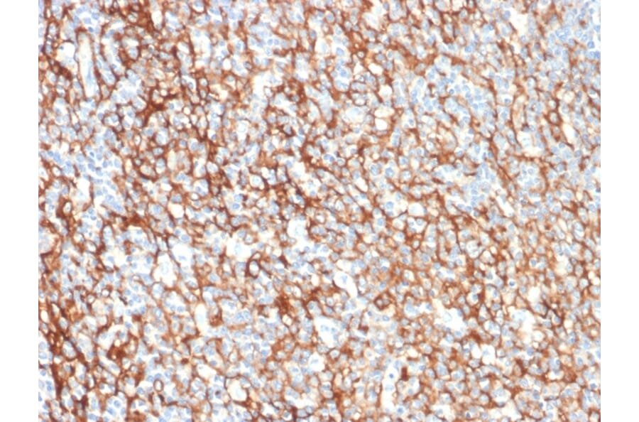 Immunohistochemistry - Anti-CD73 Antibody [NT5E/2505] (A249537) - Antibodies.com