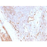 Immunohistochemistry - Anti-CD73 Antibody [NT5E/2505] (A249537) - Antibodies.com