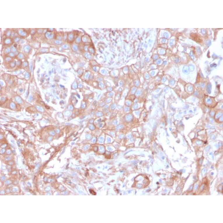 Immunohistochemistry - Anti-CD73 Antibody [NT5E/2505] (A249537) - Antibodies.com