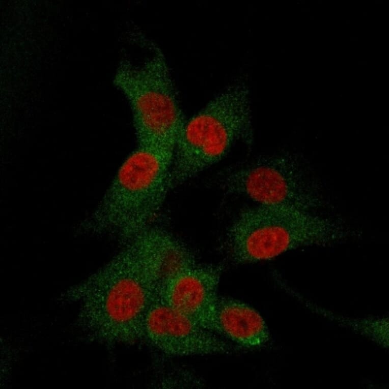 Immunofluorescence - Anti-CD73 Antibody [NT5E/2505] (A249537) - Antibodies.com