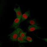 Immunofluorescence - Anti-CD73 Antibody [NT5E/2505] (A249537) - Antibodies.com