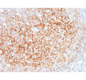 Immunohistochemistry - Anti-CD73 Antibody [NT5E/2545] (A249538) - Antibodies.com