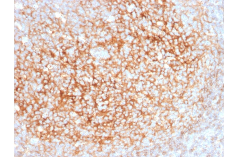 Immunohistochemistry - Anti-CD73 Antibody [NT5E/2545] (A249538) - Antibodies.com
