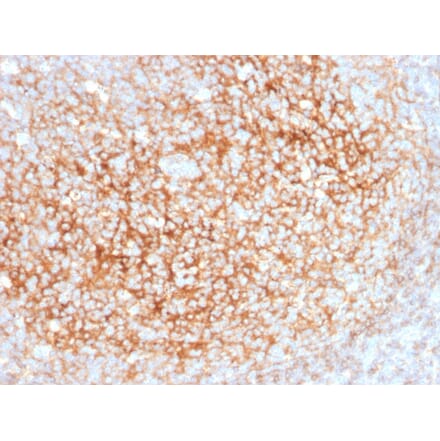 Immunohistochemistry - Anti-CD73 Antibody [NT5E/2545] (A249538) - Antibodies.com