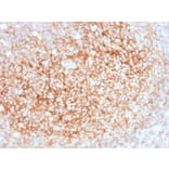 Immunohistochemistry - Anti-CD73 Antibody [NT5E/2545] (A249538) - Antibodies.com