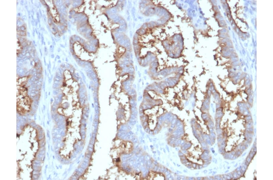 Immunohistochemistry - Anti-CD73 Antibody [NT5E/2545] (A249538) - Antibodies.com