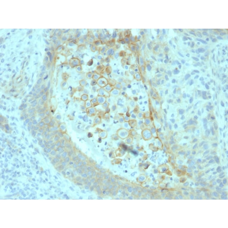 Immunohistochemistry - Anti-CD73 Antibody [NT5E/2545] (A249538) - Antibodies.com