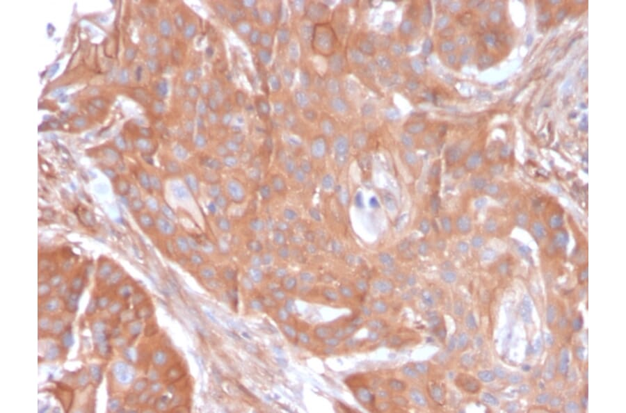 Immunohistochemistry - Anti-CD73 Antibody [NT5E/2545] (A249538) - Antibodies.com