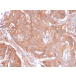 Immunohistochemistry - Anti-CD73 Antibody [NT5E/2545] (A249538) - Antibodies.com