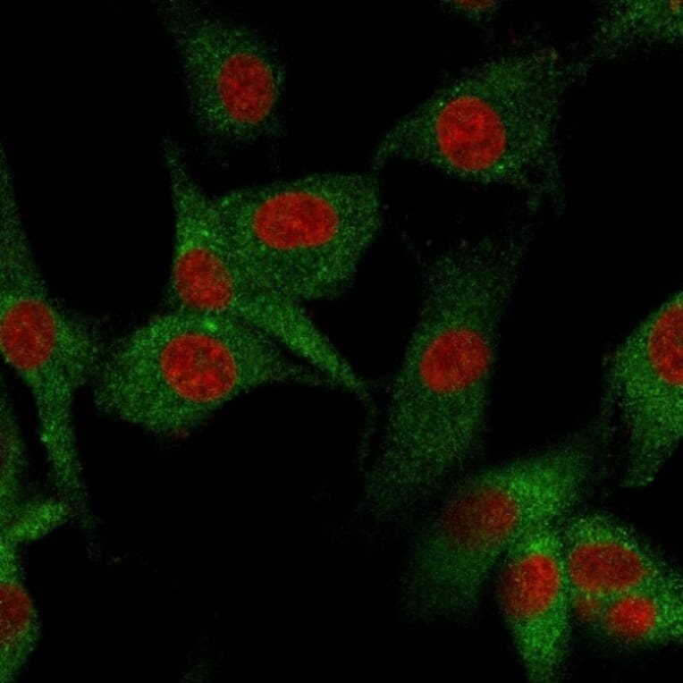 Immunofluorescence - Anti-CD73 Antibody [NT5E/2545] (A249538) - Antibodies.com