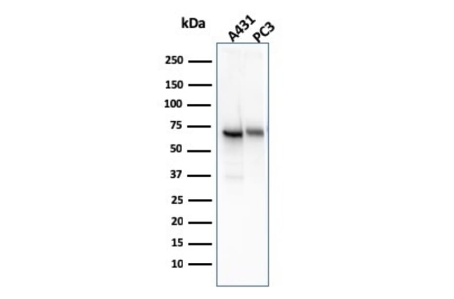 Western Blot - Anti-CD73 Antibody [NT5E/2545] (A249538) - Antibodies.com