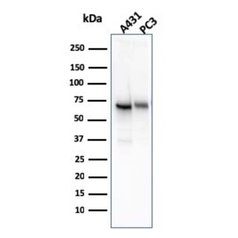 Western Blot - Anti-CD73 Antibody [NT5E/2545] (A249538) - Antibodies.com