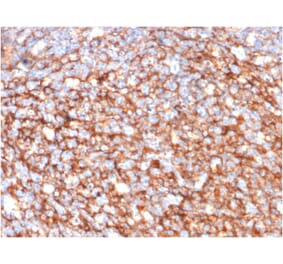 Immunohistochemistry - Anti-CD73 Antibody [NT5E/2646] (A249539) - Antibodies.com